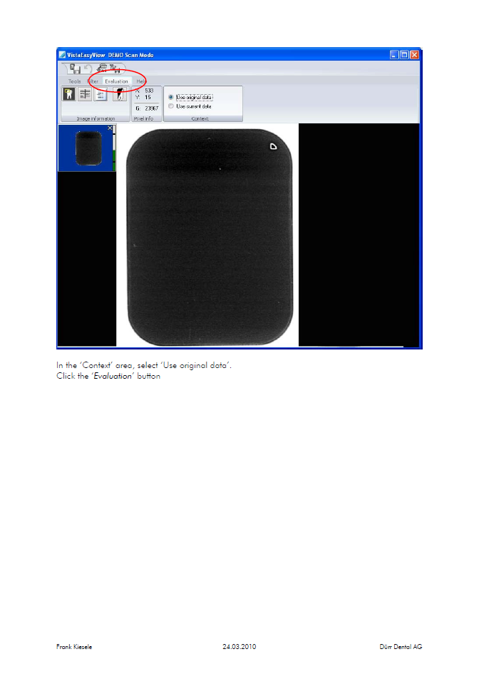 Duerr - dose calculations.2.PNG
