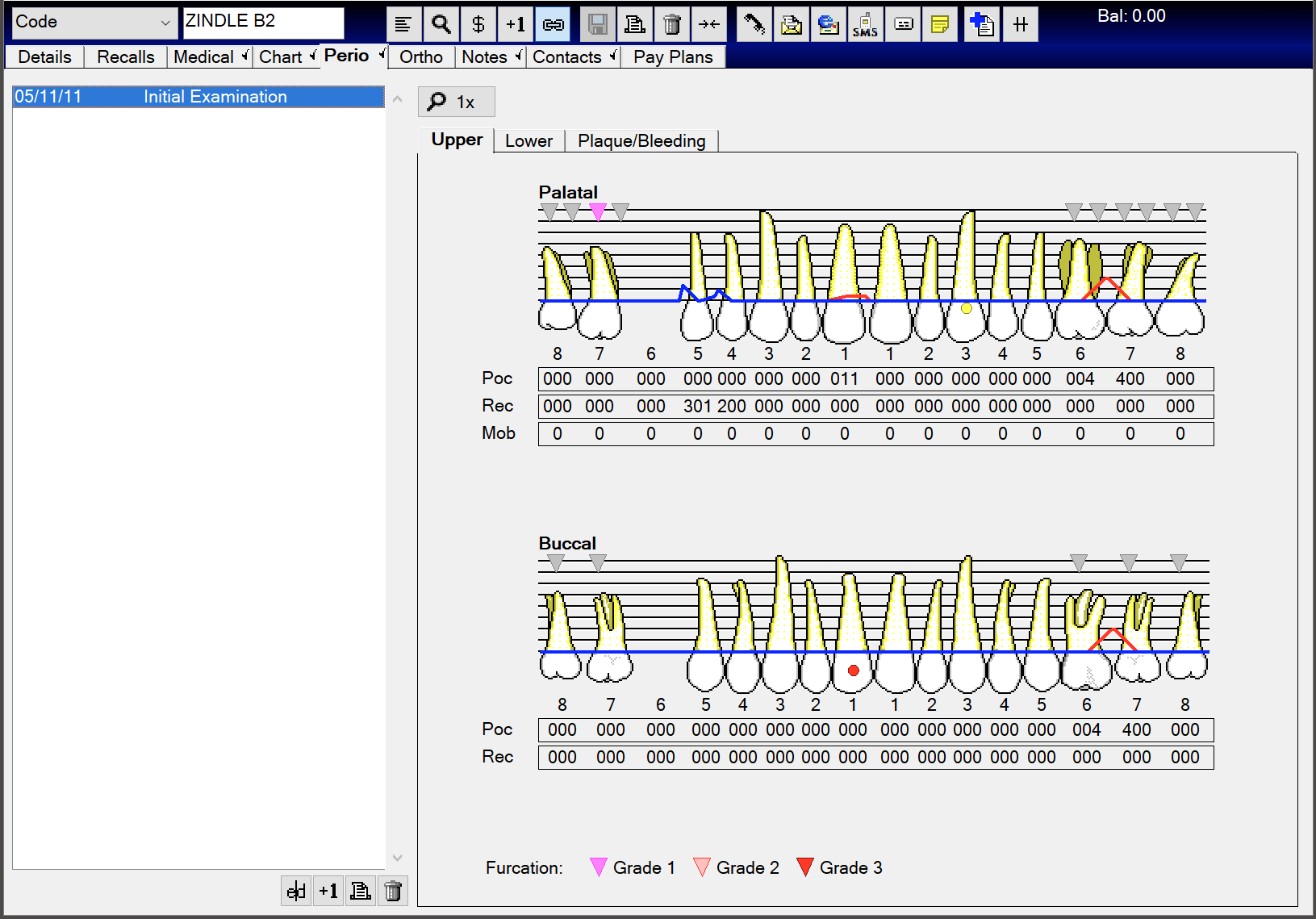 Original Perio Charting – EXACT Help Centre