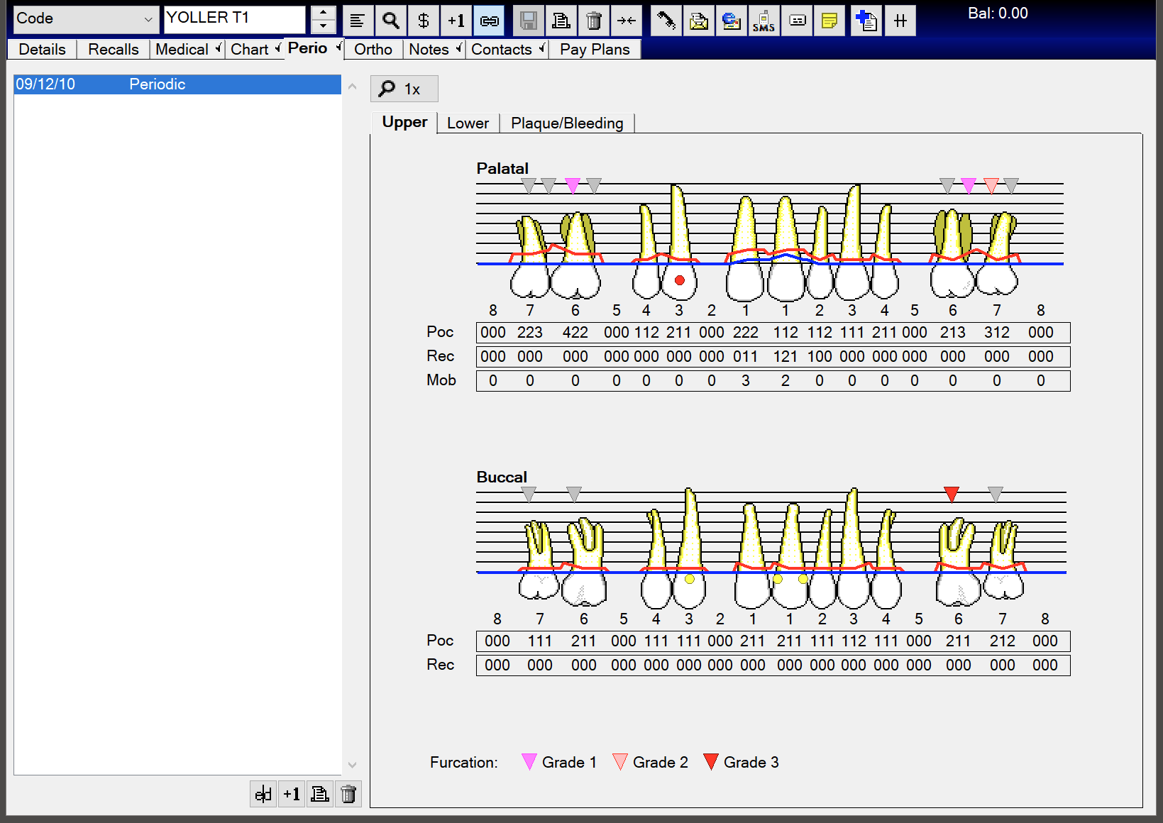 Original Perio Charting EXACT Help Centre