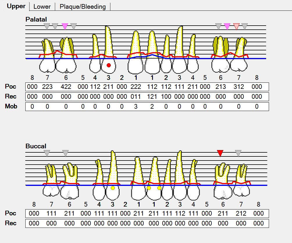 Original Perio Charting EXACT Help Centre