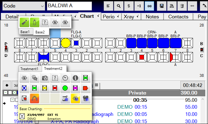 Understanding the Tooth Chart – EXACT Help Centre