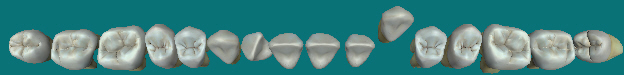 mceclip9.png