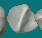 2d-charting-rotated-tooth.png